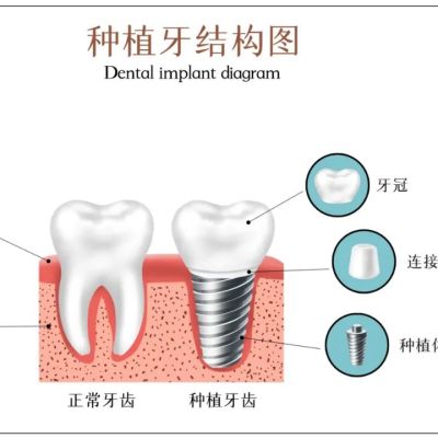 Причины шатания зубов
