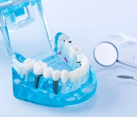 Все еще сомневаетесь, стоит ли выпрямлять зубы? Все, что вы хотите знать, здесь!