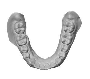 Новая технология для нового 3D-сканера